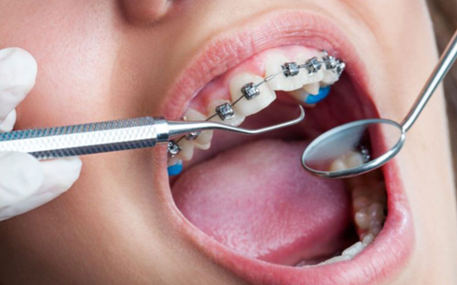 Gaziantep Ortodontist